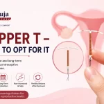 Copper T – When to Opt For It