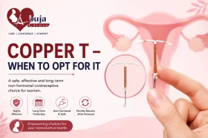 Copper T – When to Opt For It