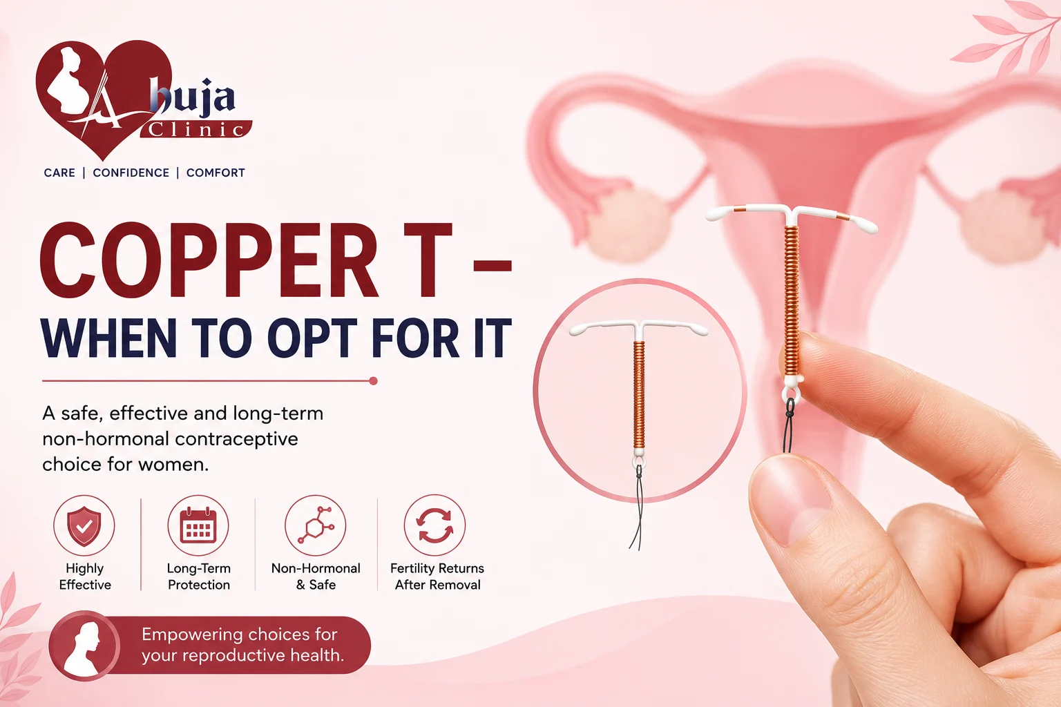 Copper T – When to Opt For It
