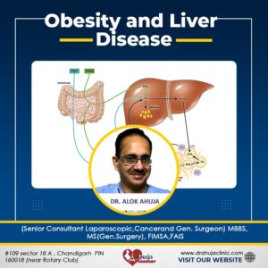 Obesity and Liver Disease