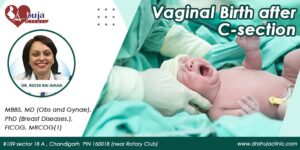 Vaginal Birth after C-section