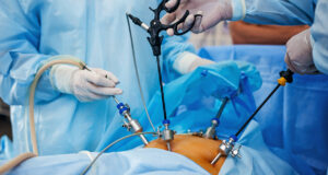 Gynecological Laparoscopic Surgery