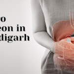 Gastro Surgeon In Chandigarh | Gastroenterologist In Chandigarh