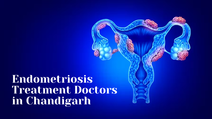 Endometriosis Treatment Doctors In Chandigarh