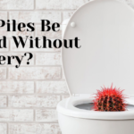 Can Piles Be Cured Without Surgery?