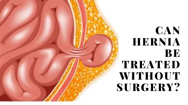 Can Hernia Be Treated Without Surgery