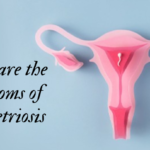 what are the symptoms of endometriosis?