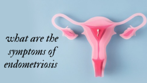 what are the symptoms of endometriosis?