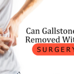 Can Gallstones be removed without surgery?