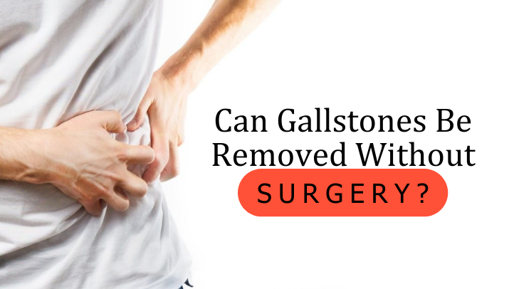 Can Gallstones Be Removed Without Surgery?