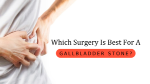 Which Surgery Is Best For A Gallbladder Stone?