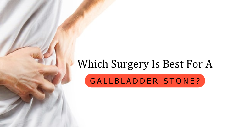 Which Surgery Is Best for a Gallbladder Stone