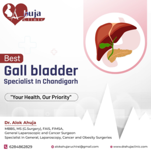 Which Surgery Is Best for a Gallbladder Stone 