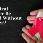 Can Oral Cancer Be Cured Without Surgery -