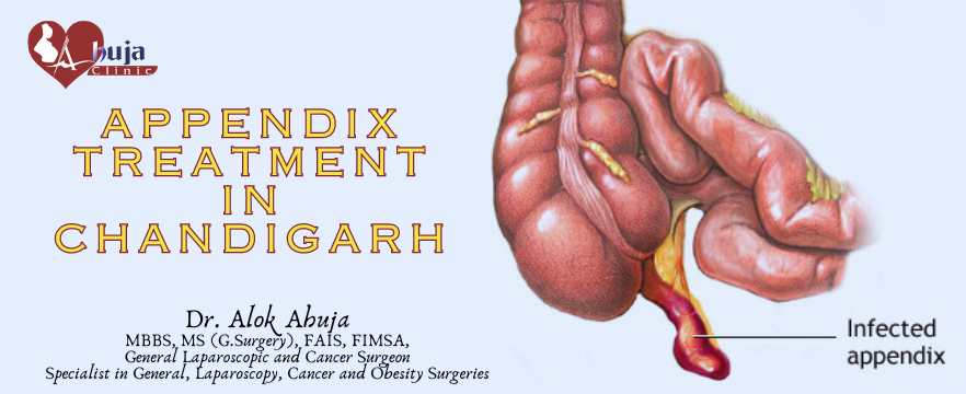 appendix treatment in Chandigarh