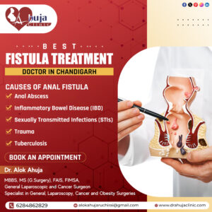 Advanced Laser Treatment For Piles, Fissures & Fistula