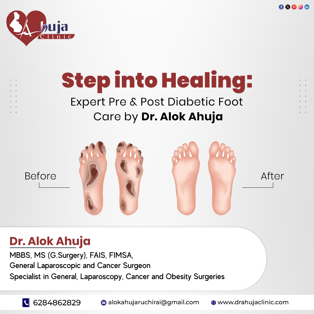 Diabetic Foot and Ulcer Treatment in Chandigarh