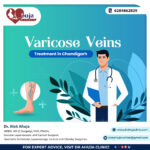 Varicose Veins Treatment in Chandigarh