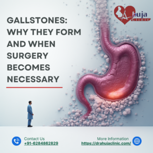 Gallstones Why they form and when surgery becomes necessary