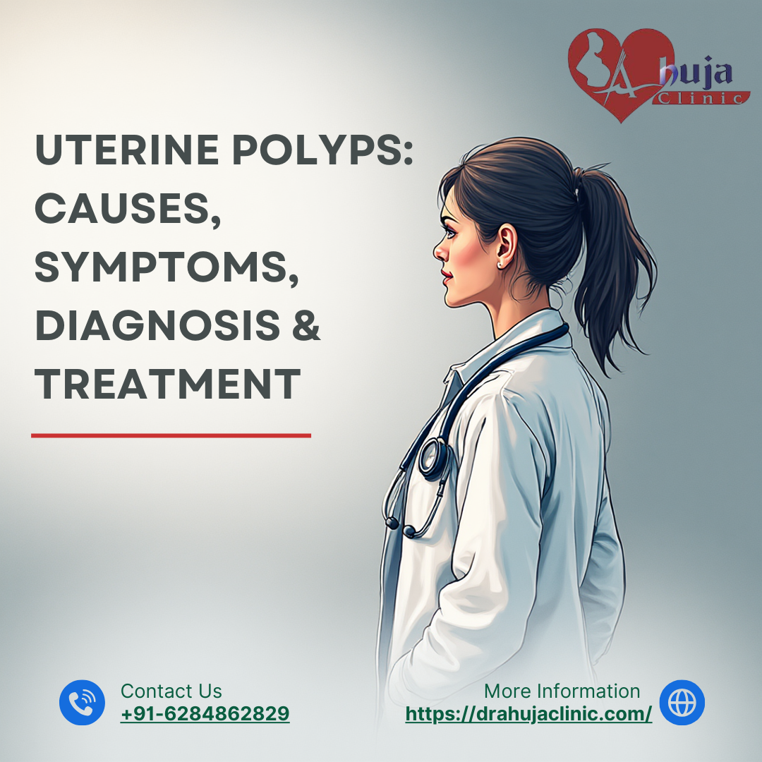 Uterine Polyps: Causes, Symptoms, Diagnosis & Treatment
