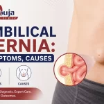 Umbilical Hernia: Symptoms, Causes