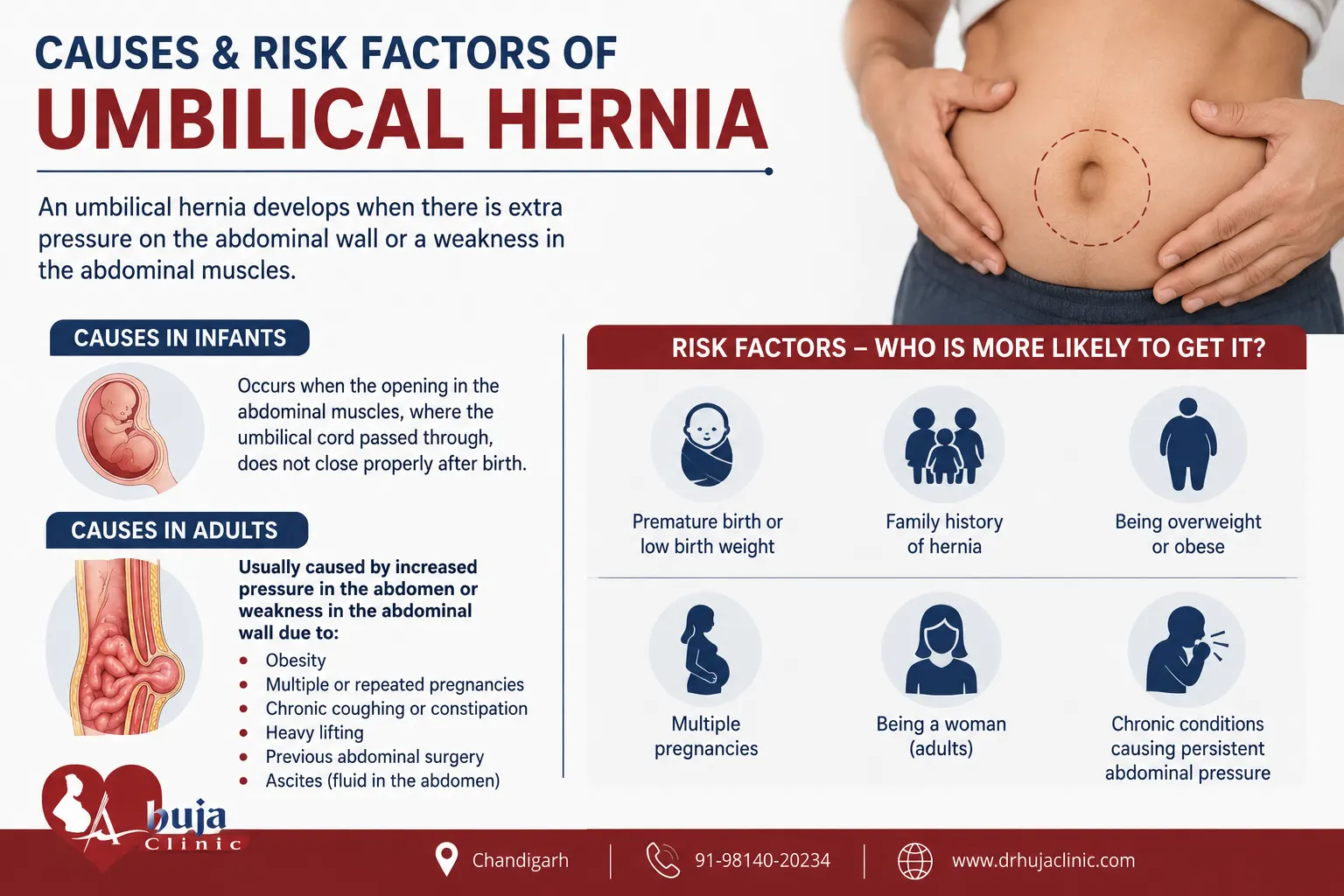 Umbilical Hernia: Symptoms, Causes
